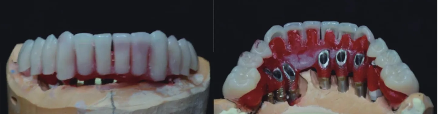 Fig 1-20.  novo.lign 배열된 협설면의 사진