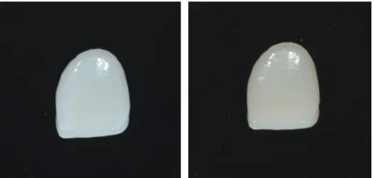 Fig. 1.  같은 광원과 같은 카메라로 IPS e.max 크라운의 삭제 전(좌)과 바깥쪽 2mm를 삭제한 후(우)의 색상의 비교. 거칠어진 표면의  도재는 원치 않는 빛의 산란을 일으키며, 광택, 표면질감, 투명도를 변화시킨다.