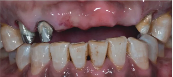 Fig. 19는 기존의 불투명 블록에 기본적으로 A2의 색이 들어가 있는 Shade Block이다. Fig. 20은 새롭게 개발된 그 라데이션  블록(gradation block)이다