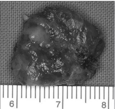 Fig. 3. Intraoperative view. Uncovered hard palate after excision  of the cyst.