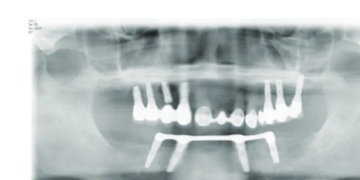 Fig. 1.  2008년 파노라마 사진 Fig. 2.  2009년 파노라마 사진