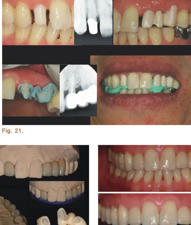 Fig. 22. Fig. 23.