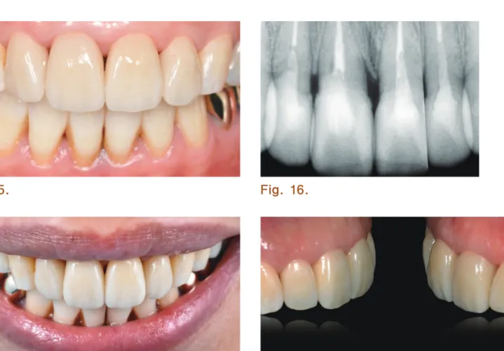 Fig. 17. Fig. 18.