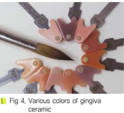 Fig 3 . Use gingiva shade guide to select a color