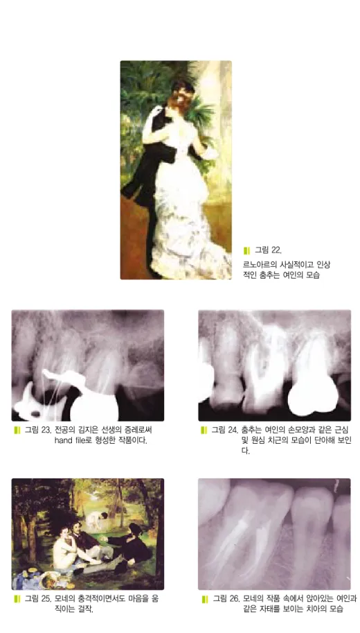그림 25. 모네의 충격적이면서도 마음을 움 직이는 걸작. 
