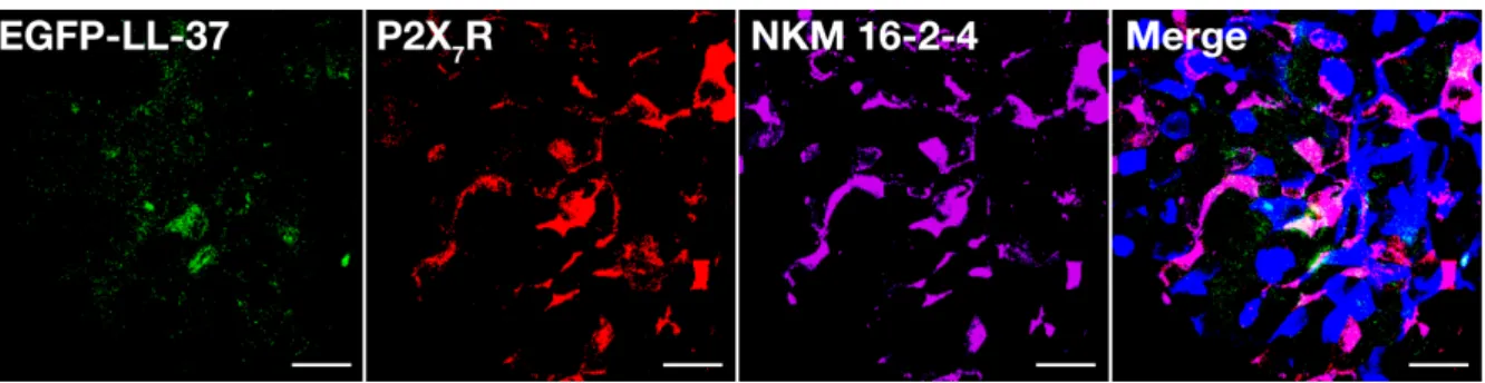 Figure 4. ATP-gated P2X 7 R may function as an M cell-targeting receptor. Whole-mount PP specimens excised from mice 10 min after oral  administration of EGFP-LL37 (green) were stained with anti-P2X 7 R (red), NKM 16-2-4 (purple), and WGA (blue)