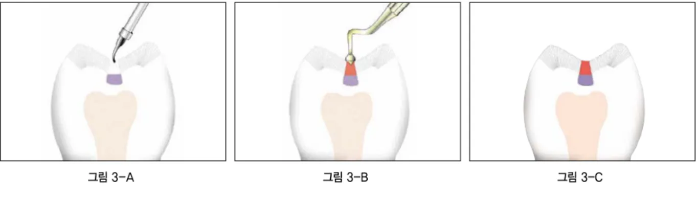 그림 3