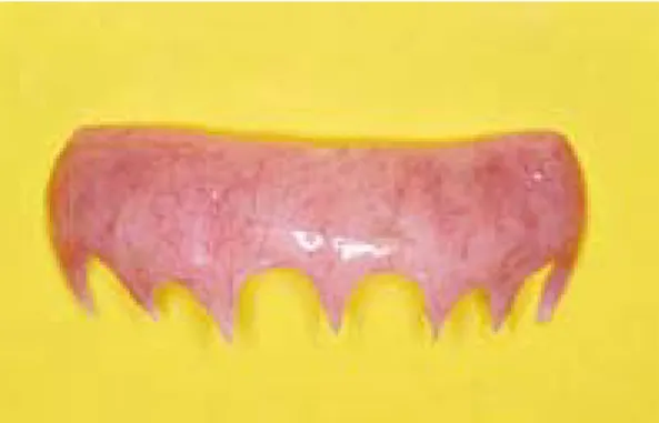 그림 9-3.   Gingival mask 장착한 정면모습으로 black space가 소실되 었다.