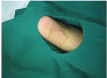 Fig. 1- 6. sterilization and dressing the wound with stick- stick-ing plaster