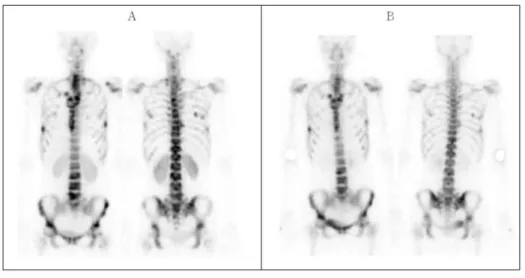 Figure  2.  Bone  scan