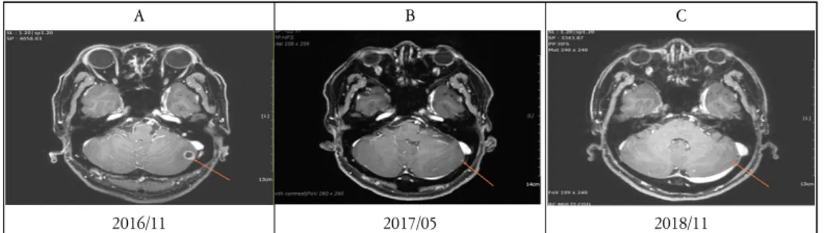 Figure  2.  Comparison  of  brain  magnetic  resonance  imaging