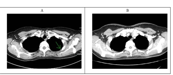 Figure  1.  Chest  Computed  Tomography