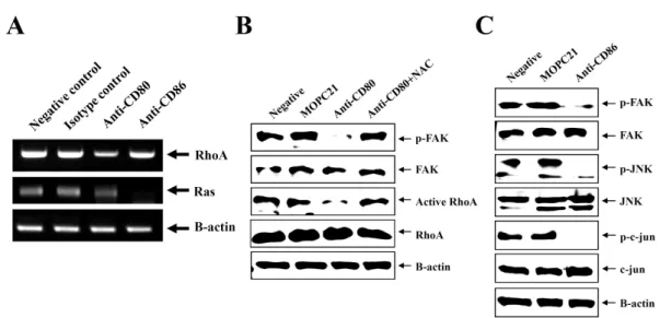 Figure 5. Activation of RhoA, Ras, FAK, and JNK after CD80 and CD86 stimulation. (A) EBV-transformed B cells (5×10 5 cells/well, 200 ul) were triggered on anti-CD80/86 antibody (5 ug/ml) plates for 1 hour