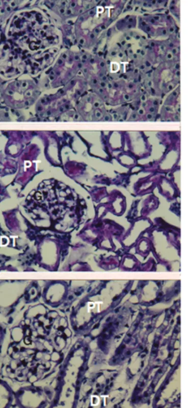 Fig. 4. Light micrograph of kidney from normal(A), control(B), and sample(C) groups. G, glomerulus; PT, Proximal tubule; DT, distal tubule
