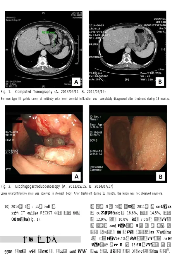 Fig. 1.  Computed Tomography (A. 2013/05/14. B. 2014/06/19) 