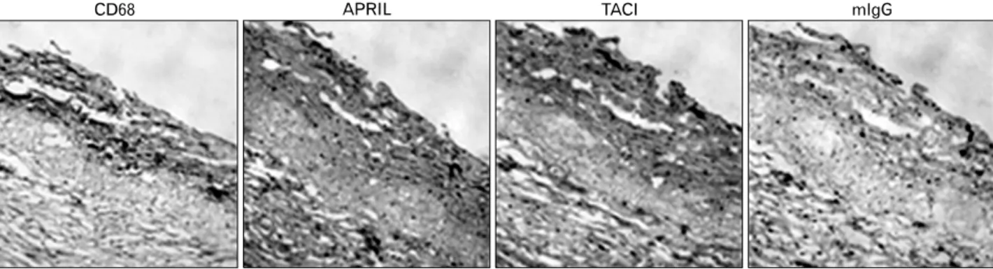 Figure 4. Macrophages in human atherosclerotic plaques express both APRIL and TACI. Consecutive sections of an atherosclerotic plaque were  stained with mAbs against CD68 (a marker for macrophages), APRIL, or TACI