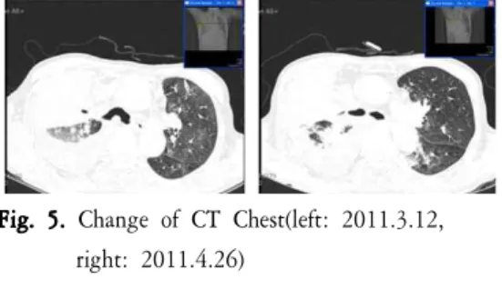 Fig. 5. Change of CT Chest(left: 2011.3.12, right: 2011.4.26)