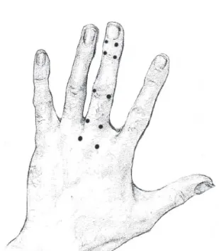 Fig 1. Acupoints of Hand Acupuncture 