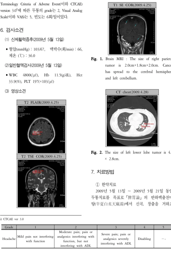 Fig. 1. Brain MRI : The size of right parietal tumor is 2.0cm×1.8cm×2.0cm. Cancer has spread to the cerebral hemisphere and left cerebellum.