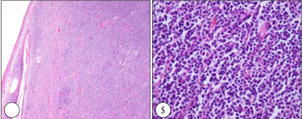 Fig. 4. Postoperative 6 months view reveals absence of recur- recur-rence. 