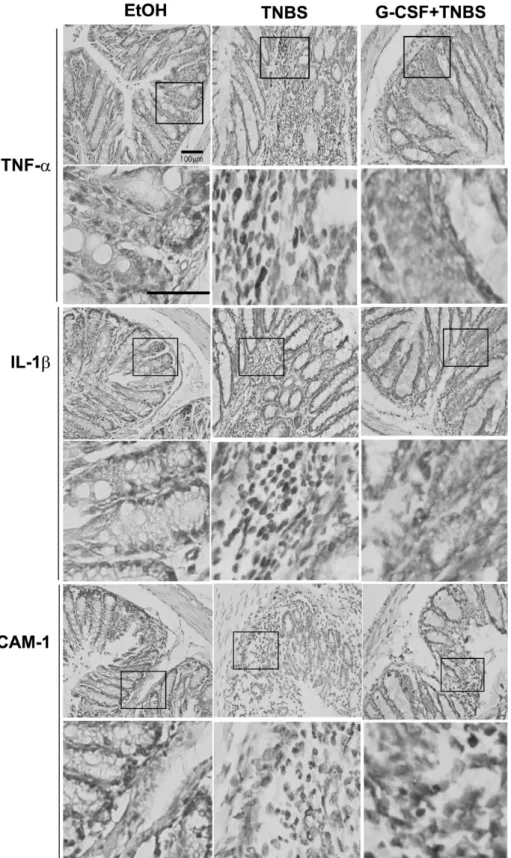 Figure 4. G-CSF reduces the expre- expre-ssion of TNF-α IL-1β, and ICAM-  1 in colonic mucosa of TNBS colitis.
