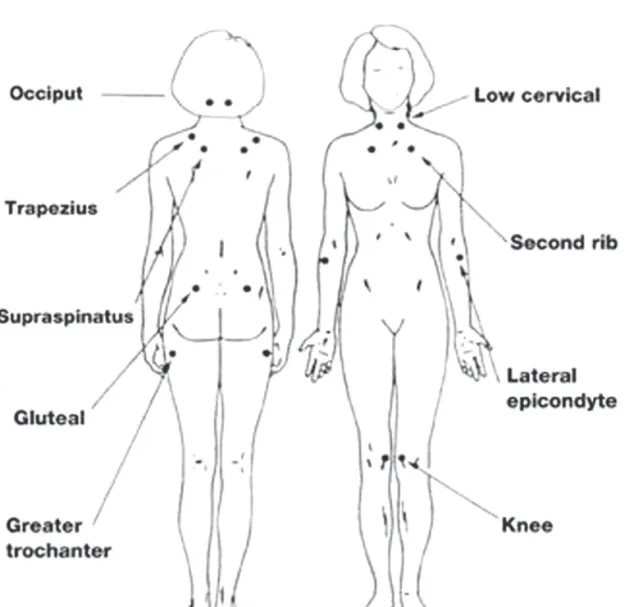 Fig. 1. Test of FMS