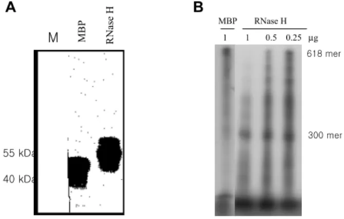 Figure 4.  Bst O1 fingerprinting of antibody library. M is 100 bp ladder marker. Lane 1 to lane 16 were Bst  O1  digested  PCR  products of 16 different clones selected randomly from library.