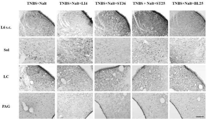 Figure 8. The role of endogenous opioid reversing the effect of pharmacopunctures on the expression of c-Fos like pro- pro-tein at 24 hours after TNBS induced colitis