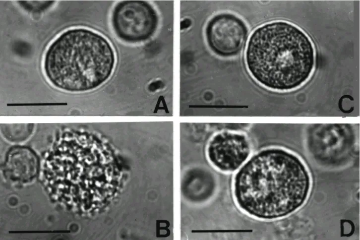 Figure 1. Light microphotographs using inverted microscopy of rat peritoneal mast cells (arrows, RPMC) in HEPES-Tyrode buffer (A), after stimulation with 5μg/ml compound 48/80 (B) and 1 mg/ml Rubus coreanus water extract (RCWE) (C), after being pretreated 