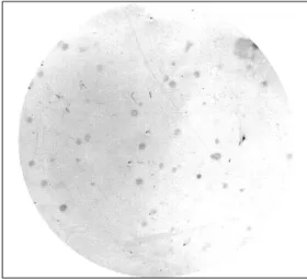 Figure 2. Colony lift assay for the selection of TP specific scFv expressing colony. Thirty four positive colonies were detected