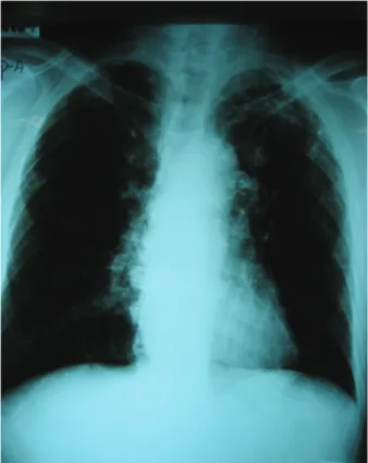 Fig. 1. Chest PA(2009.12.4)