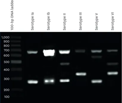 Figure 2. Representative 2% agarose gel showing typing patterns of recovered Group B streptococcus isolates  using capsular gene-based multiplex polymerase chain reaction