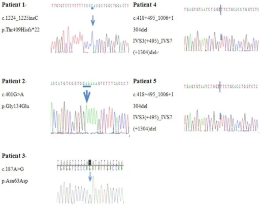 Fig. 1. Partial sequences of IDS gene (Patient 1-5) showing the mutations detected in this study.