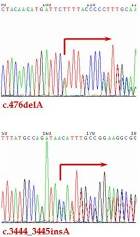 Fig.  1.  환자의  AGL  유전자  염기서열분석  결과. 환자는  정상적인  사회활동을  하며  생옥수수  전분이  포함된 식이 치료를 유지하였고, 단백질 제한은 하지 않 았다