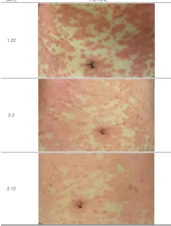 Table  5.  Changes  in  abdominal  skin  Photo  (1)