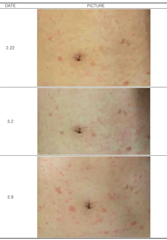 Table  6.  Changes  in  abdominal  skin  Photo  (2)