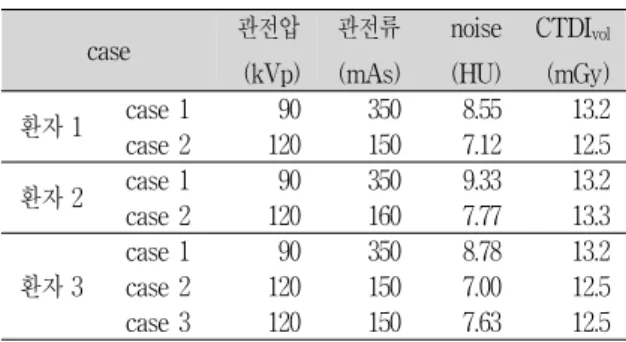 Fig.  1.  MTF  0.2에  해당하는  spatial  frequency  수치