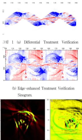 그림  1  (a)  Differential  Treatment  Verification  Sinogram.