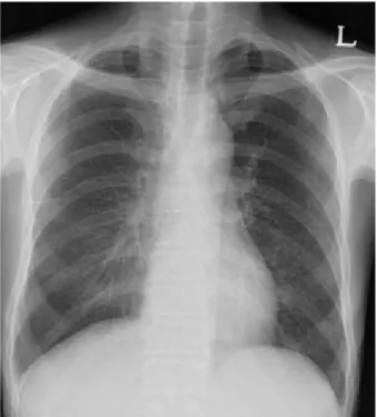 Figure 1. Miliary nodules were observed in both lung fields.