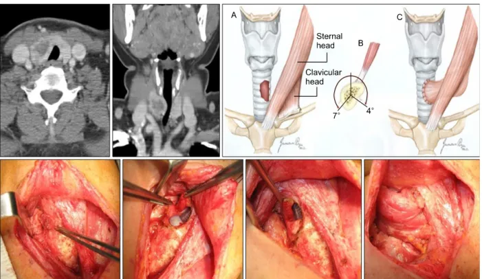Fig.  4.  Trough  method  and  tracheotomy.