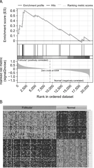 Fig.  5.  mRNA  gene  expression  differences  between  follicular variant papillary thyroid carcinoma and normal TCGA samples (Threshold: FDR 25%)