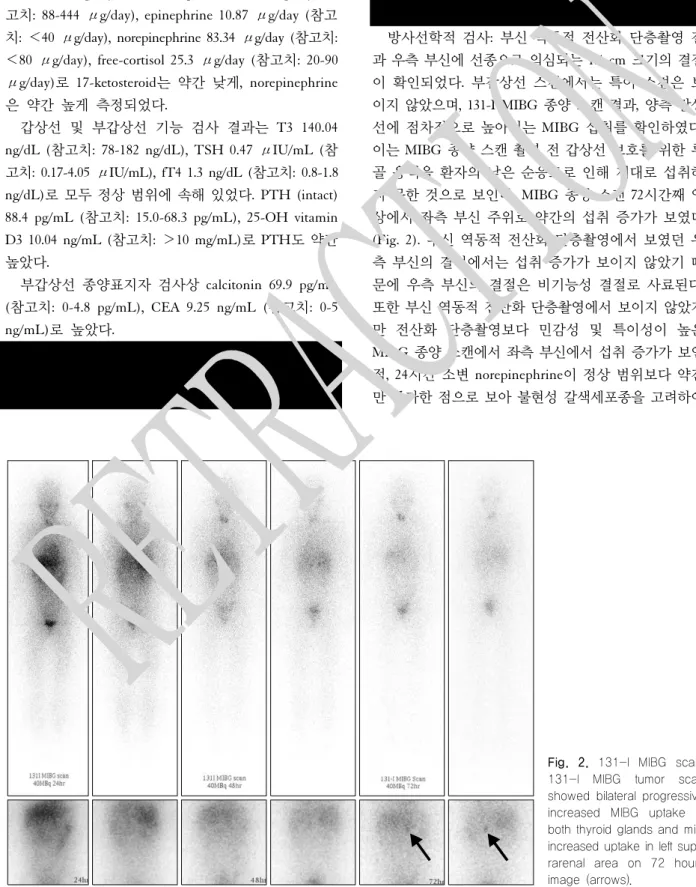 Fig.  2.  131-I  MIBG  scan. 