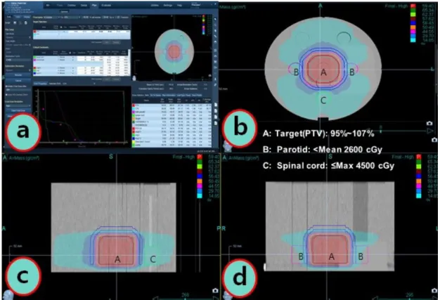 Fig. 3.  Precision ® 	Treatment	Planning	System(Version	1.1.1.1)	(a)	Treatment	plan	for	virtual	Hypopharynx	 Patients,	(b)	Axial	image,	(c)	Sagittal	image,	(d)	Coronal	image Table 2