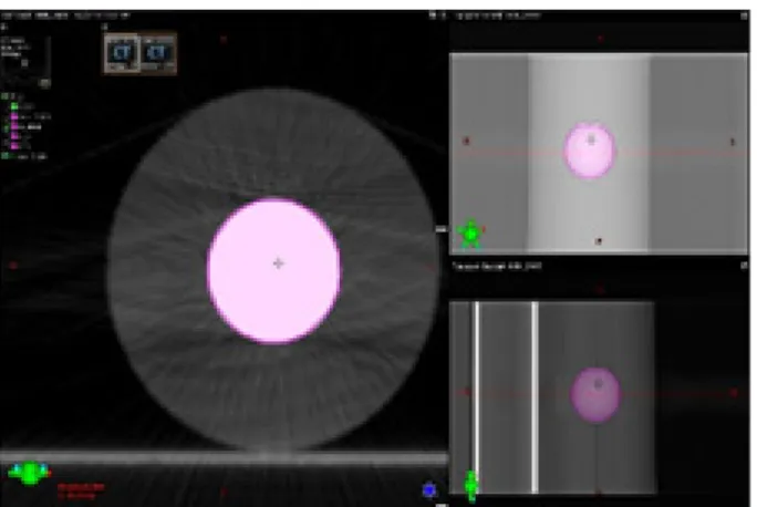 Fig. 1.  (a)	Iron	Beads	kVCT	image,	(b)	Iron	Beads	MVCT	 Image