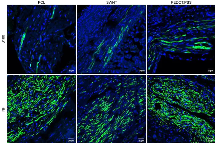 Fig. 7. The expression of NF and S100 protein at 8 weeks. The NF and S100 protein in all groups were well expressed