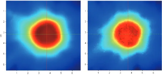 Fig. 5-1.  Comparison	between	TPS	and	film	dose	distribution	in	diameter	2	cm.