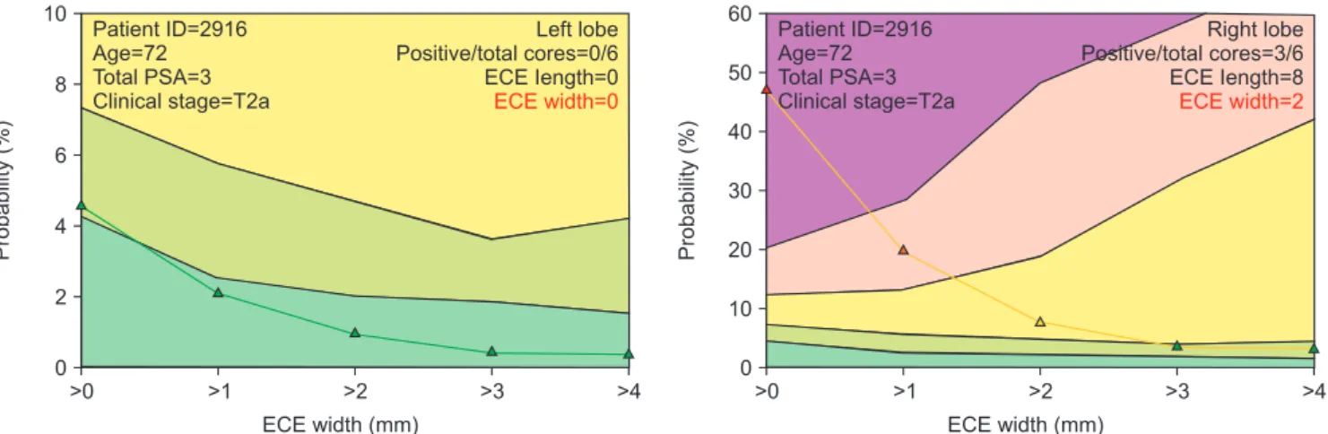 Fig. 1. Output yielded by the graphical user interface for a 72-year-old patient with T2a clinical stage and a prostate-specific antigen (PSA) level  of 3 ng/mL
