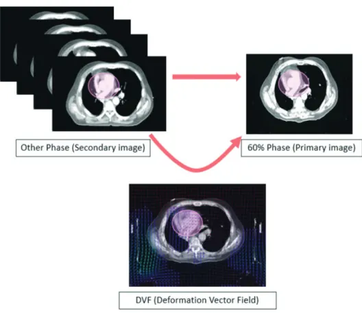 Fig. 1. Deformable Image Registration and Deformation Vector Field