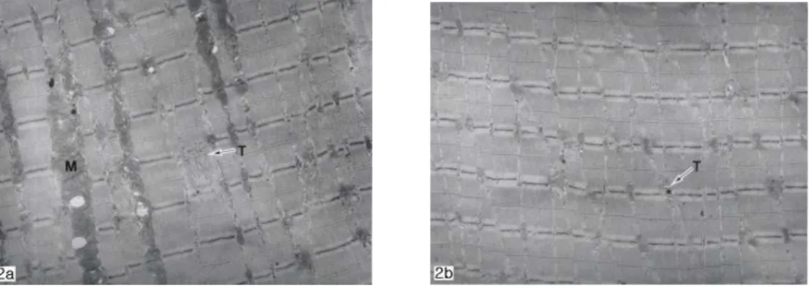 Fig 2. Ultrastructure of myofibrils of control in rats, uranyl acetate and lead citrate, original mag.×6,000