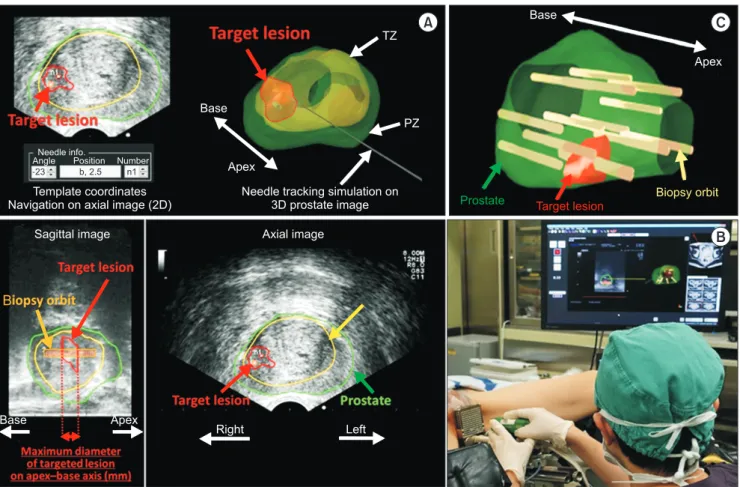 Fig. 3. Elastic fusion of MRI and TRUS. 